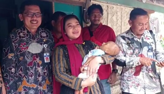 Pemkab Brebes Jamin Biaya Pengobatan Bagi Balita Gizi Buruk